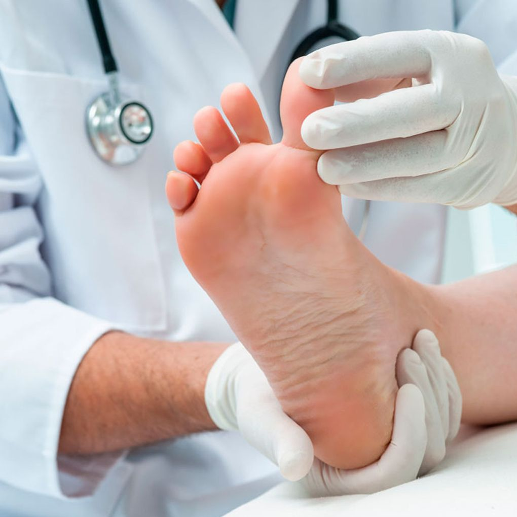 Diabetic Foot Screening